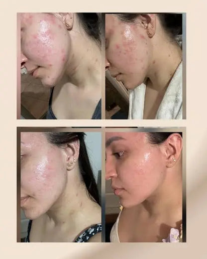 HarmoGlow™ – Tu equilibrio hormonal y belleza desde adentro.